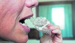Modelo del dispositivo de avance mandibular provisional, que se utiliza entre 3 y 6 meses para comprobar su efectividad antes de pasar a la prótesis definitiva. ::
ALBERTO AJA/